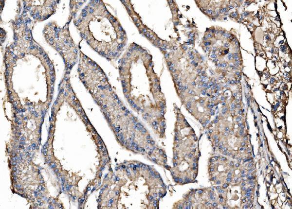 a05071 1 ktn1 primary antibodies ihc testing 4