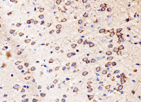 a05071 1 ktn1 primary antibodies ihc testing 5