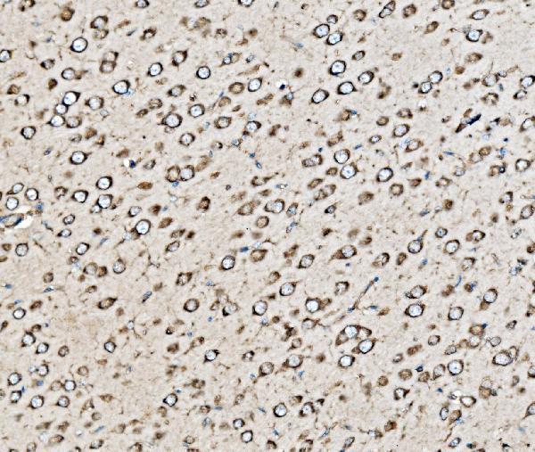 a05071 1 ktn1 primary antibodies ihc testing 6