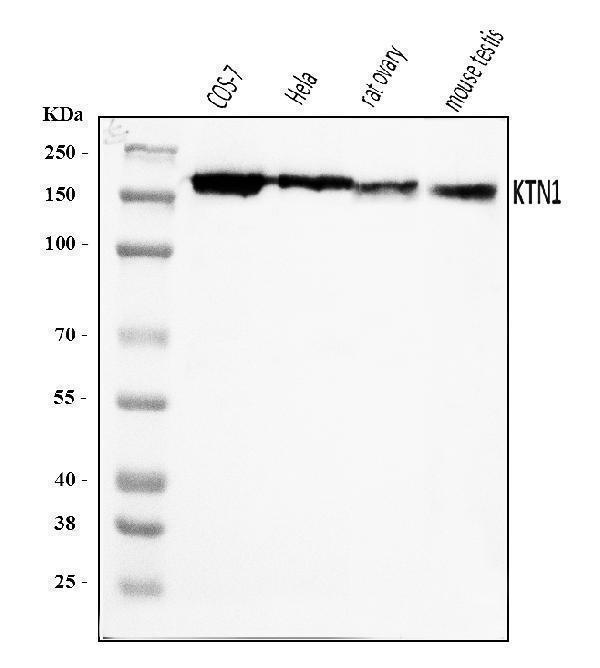  Western blot analysis of Kinectin 1/KTN1 using anti-Kinectin 1/KTN1 antibody (A05071-1)
