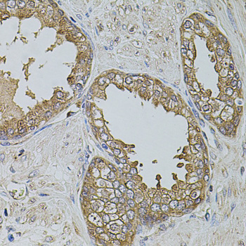 Immunohistochemistry of paraffin-embedded human prostate using KTN1 antibody  at dilution of 1:100 