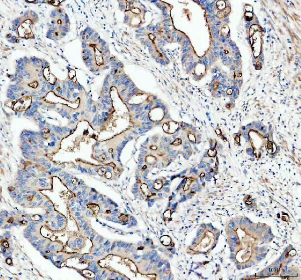 a05072 2 gprc5a primary antibodies ihc testing 1