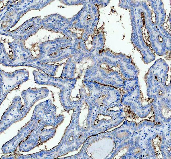 a05072 2 gprc5a primary antibodies ihc testing 2