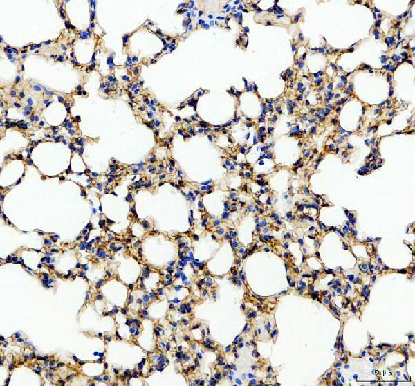 a05072 2 gprc5a primary antibodies ihc testing 3