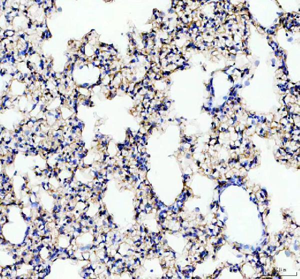 a05072 2 gprc5a primary antibodies ihc testing 4