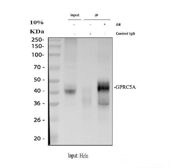 a05072 2 gprc5a primary antibodies ip testing 1