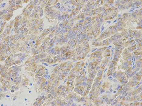 a05073 ipo5 primary antiboties wb testing 2