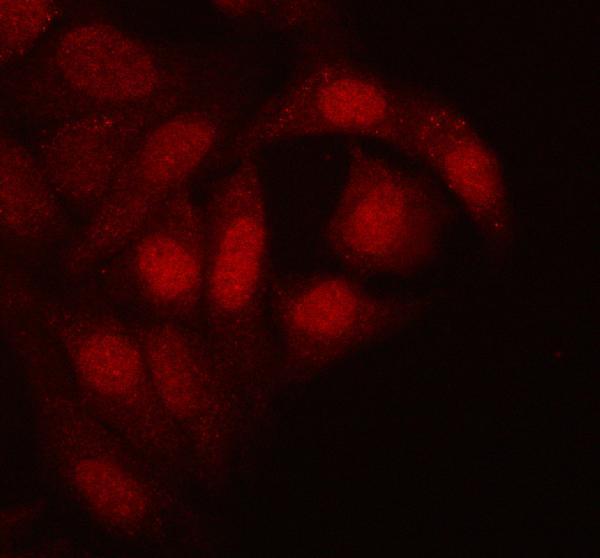a05076 2 rtcb primary antibodies if testing 9