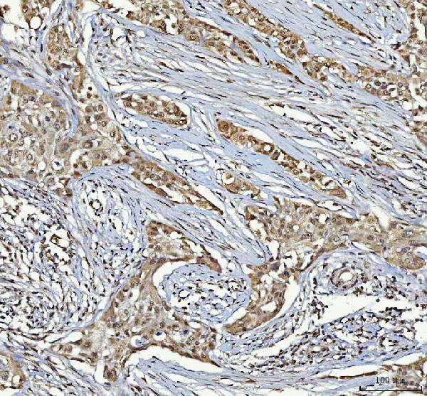 a05076 2 rtcb primary antibodies ihc testing 2