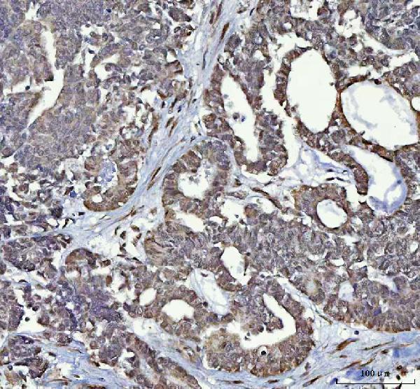 a05076 2 rtcb primary antibodies ihc testing 3