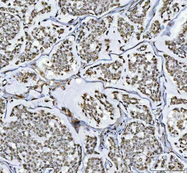 a05076 2 rtcb primary antibodies ihc testing 4