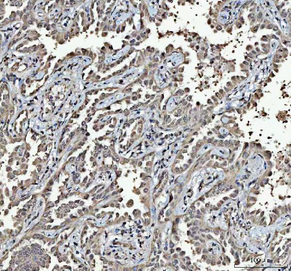 a05076 2 rtcb primary antibodies ihc testing 6