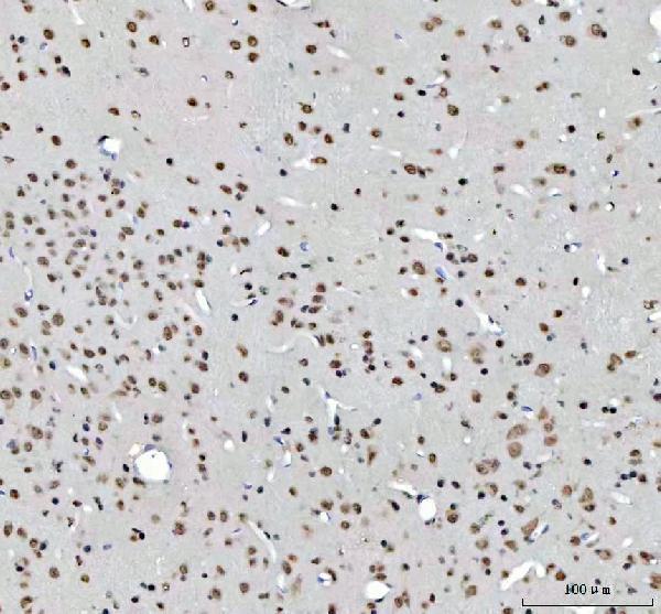 a05076 2 rtcb primary antibodies ihc testing 7