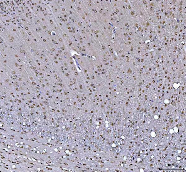 a05076 2 rtcb primary antibodies ihc testing 8