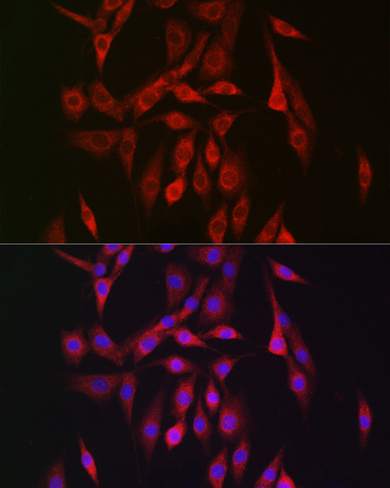 Immunofluorescence analysis of NIH/3T3 cells using PRKAB2 Rabbit pAb  at dilution of 1:150 