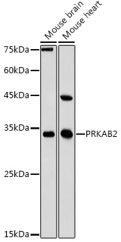 Western blot analysis of extracts of various cell lines, using PRKAB2 antibody  at 1:1000 dilution