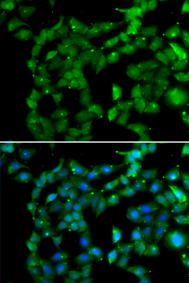Western blot analysis of extracts of Jurkat cells, using PRKAB2 antibody  at 1:1000 dilution