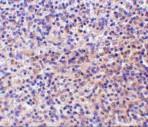 Immunohistochemistry of RP105 in human spleen tissue withRP105 antibody at 10 μg/mL