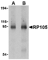 Western blot analysis of RP105 in human spleen tissue lysate with RP105 antibody at (A) 0