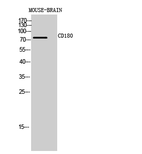 Western Blot analysis of MOUSE-BRAIN cells using CD180 Polyclonal Antibody diluted at 1:1000