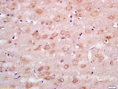 Tissue/cell: rat brain tissue; 4% Paraformaldehyde-fixed and paraffin-embedded;
Antigen retrieval: citrate buffer ( 0