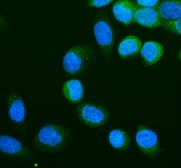 a05087 3 acsl5 primary antibodies if testing 1