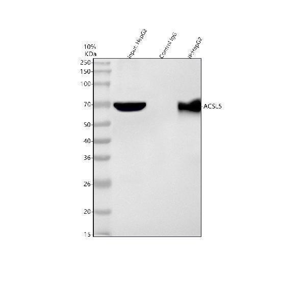 a05087 3 acsl5 primary antibodies ip testing 1