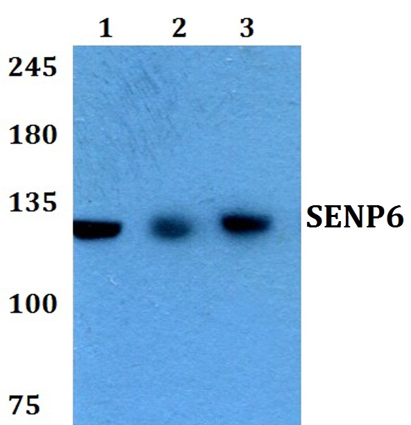 Western blot (WB) analysis of SENP6 polyclonal antibody at 1:500 dilution
Lane1:HEK293T whole cell lysate
Lane2:Raw264