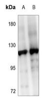 Western blot analysis of SENP6 expression in A2780 (A), HEK293T (B) whole cell lysates