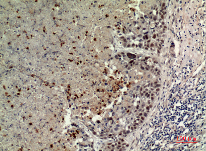 a05089 1 bcat1 primary antibodyes ihc testing 2