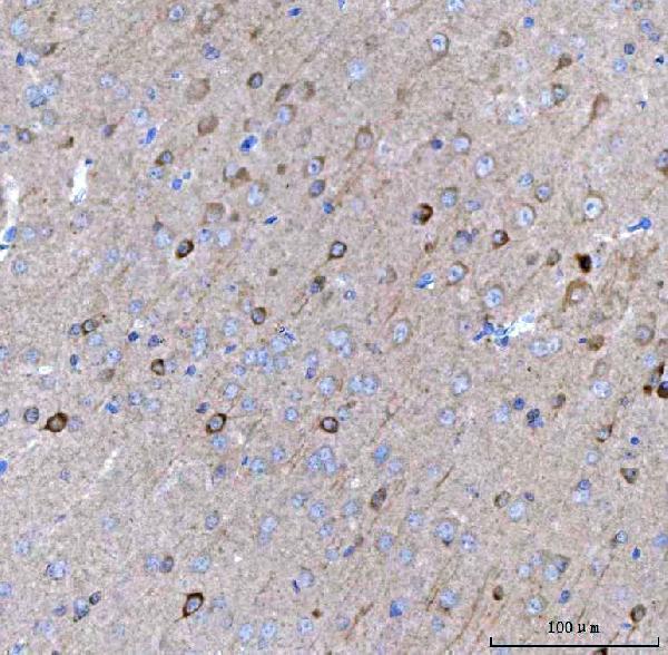 a05089 2 bcat1 primary antibodies ihc testing 3