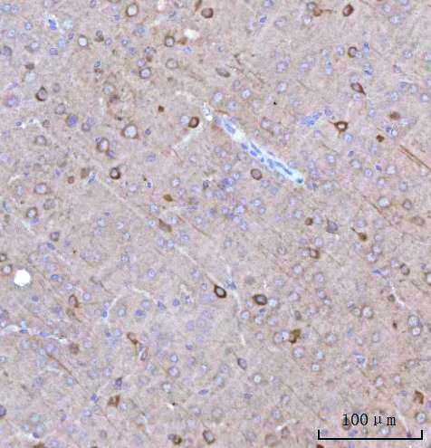 a05089 2 bcat1 primary antibodies ihc testing 4
