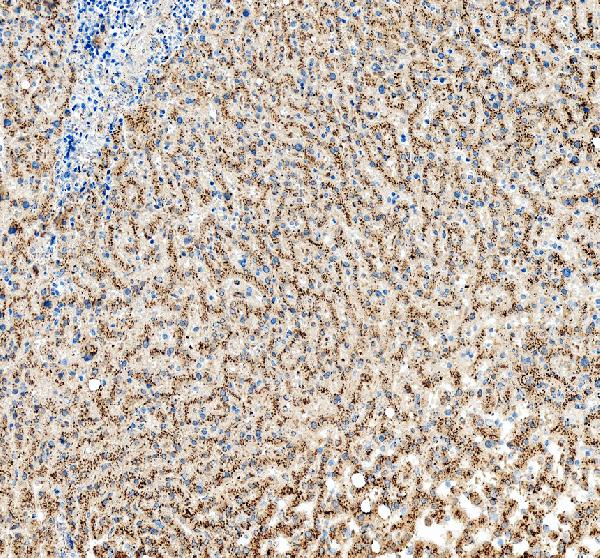 IHC analysis of SCARB2 using anti-SCARB2 antibody (A05090-1)