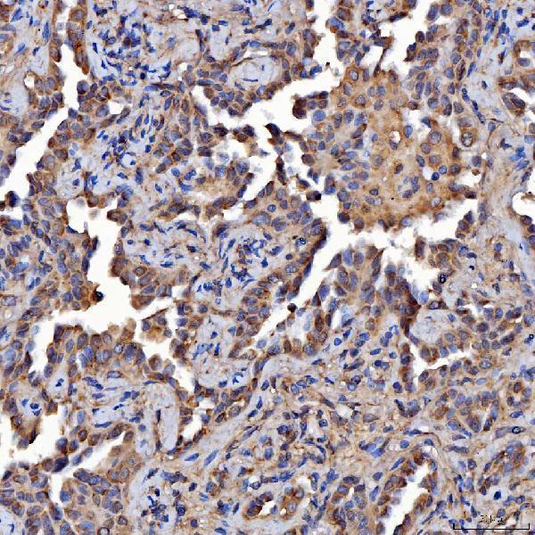  IHC analysis of Scavenging Receptor SRB2/SCARB2 using anti-Scavenging Receptor SRB2/SCARB2 antibody (A05090-1)