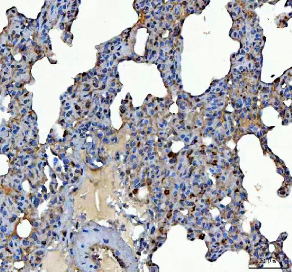IHC analysis of SCARB2 using anti-SCARB2 antibody (A05090-1)