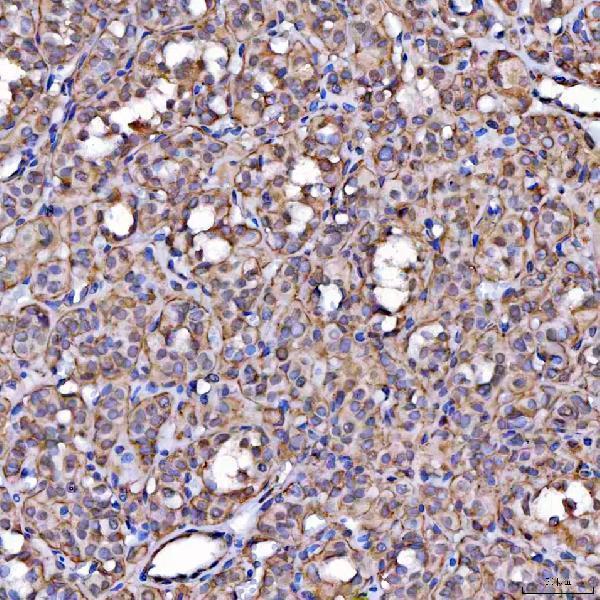 a05090 1 scarb2 primary antibodies ihc testing 5