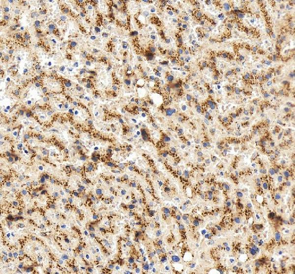 IHC analysis of LIMPII/SCARB2 using anti-LIMPII/SCARB2 antibody (A05090-1)