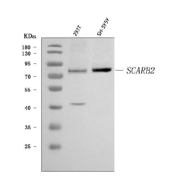  Western blot analysis of Scavenging Receptor SRB2/SCARB2 using anti-Scavenging Receptor SRB2/SCARB2 antibody (A05090-1)