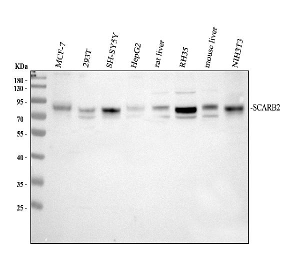 Western blot analysis of SCARB2 using anti-SCARB2 antibody (A05090-1)