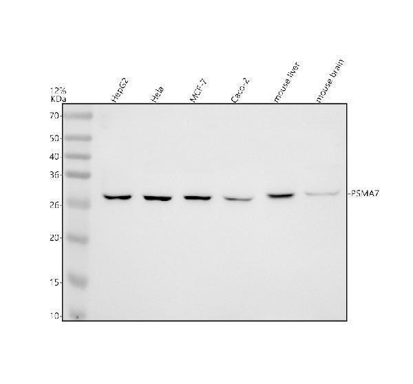 Western blot analysis of PSMA7 using anti-PSMA7 antibody (A05091-1)