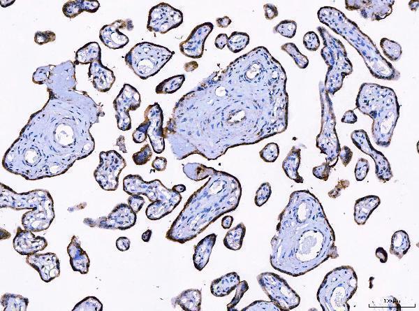  IHC analysis of LNPEP using anti-LNPEP antibody (A05092-1)