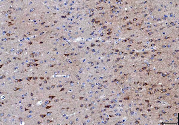  IHC analysis of LNPEP using anti-LNPEP antibody (A05092-1)