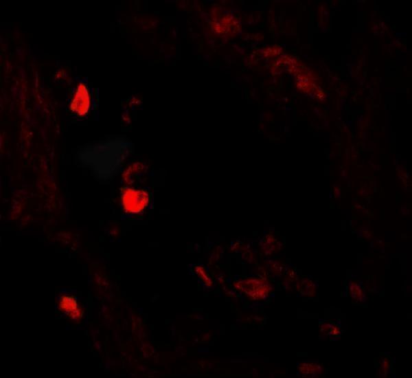 a05092 lnpep primary antibodies if testing 2