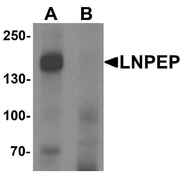 a05092 lnpep primary antibodies wb testing 1