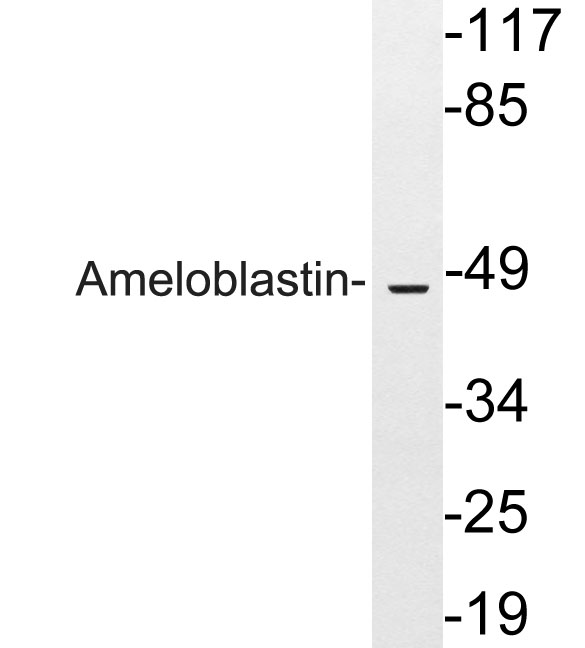 Western blot analysis of lysates from HeLa cells, using Ameloblastin antibody
