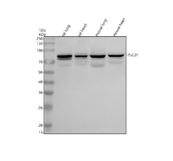 Western blot analysis of PLCD1 using anti-PLCD1 antibody (A05094-1)