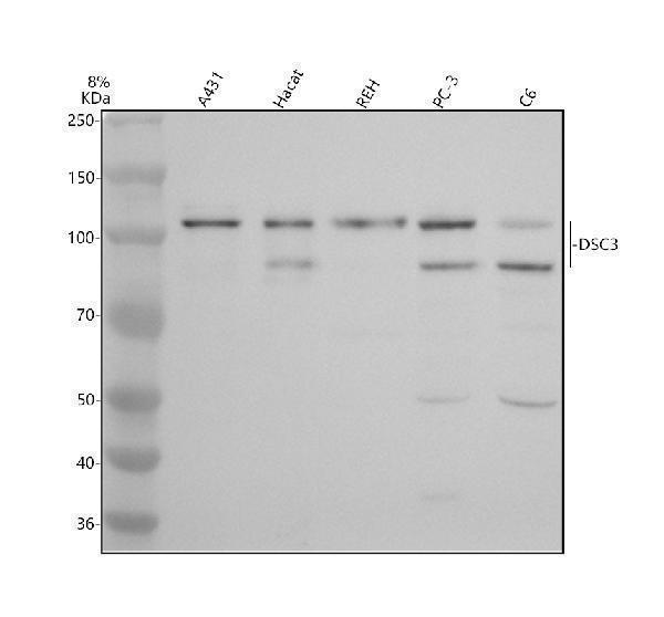 Western blot analysis of DSC3 using anti-DSC3 antibody (A05095-1)
