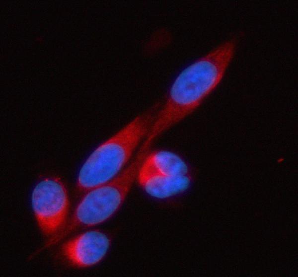 a05096 1 soat1 primary antibodies if testing 10