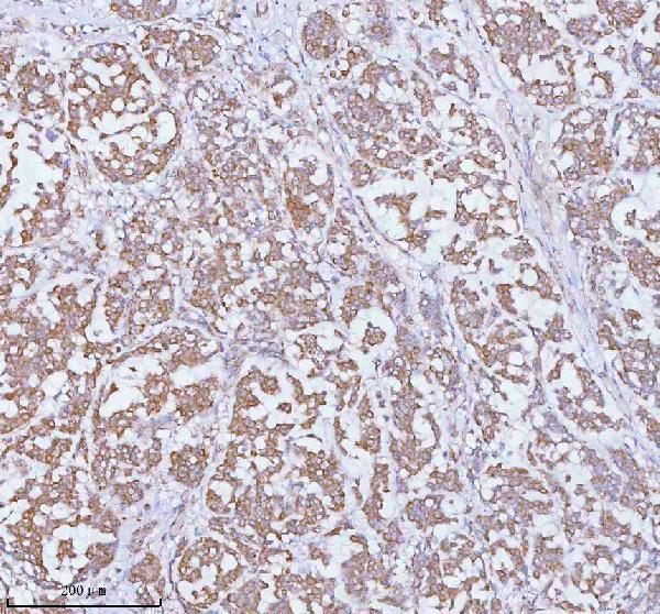 a05096 1 soat1 primary antibodies ihc testing 2