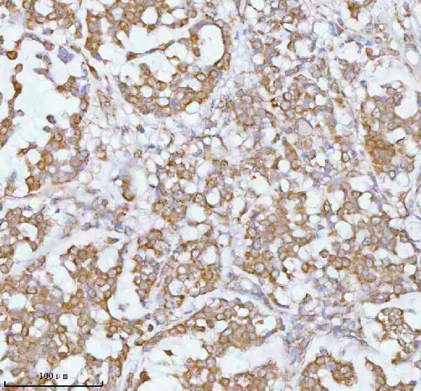 a05096 1 soat1 primary antibodies ihc testing 3